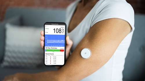 Person with diabetes uses a CGM tracker and phone app to monitor glucose